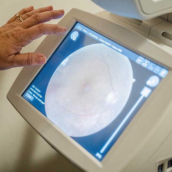 using Optomap® Digital Retinal Imaging at True Eye Experts