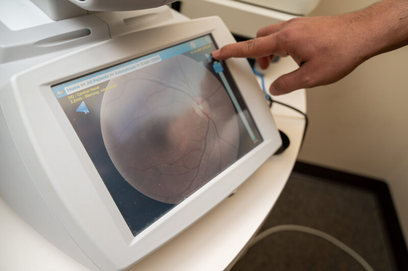 glaucoma screening at True Eye Experts